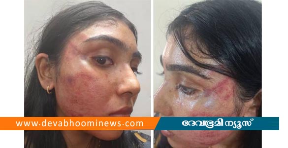 വഞ്ചിയൂരില്‍ ജൂനിയര്‍ അഭിഭാഷകയ്ക്ക് സീനിയര്‍ അഭിഭാഷകന്‍റെ ക്രൂര മർദനം