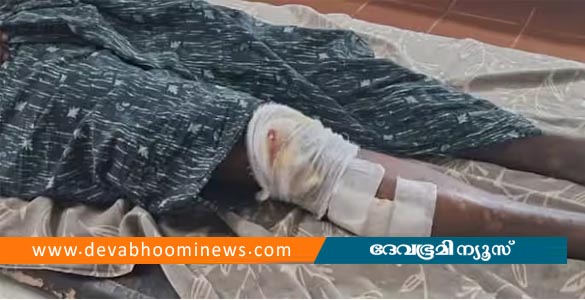 തിരുവനന്തപുരത്ത് കാട്ടു പന്നിയുടെ ആക്രമണത്തിൽ യുവാവിന് പരിക്ക്