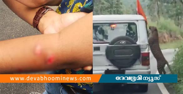 സഫാരിക്കിടെ പുലിയുടെ നഖം കൊണ്ടു; ബം​ഗളൂരുവിൽ 12കാരന് പരിക്ക്