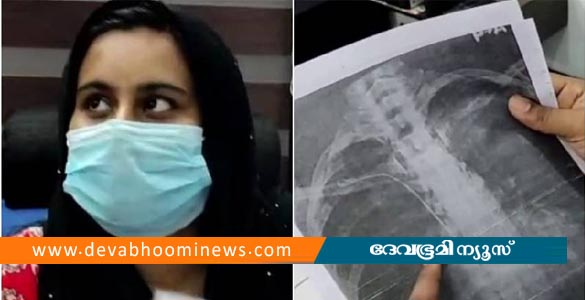 യുവതിയുടെ നെഞ്ചില്‍ ട്യൂബ് കുടുങ്ങിയ സംഭവം; ശസ്ത്രക്രിയ പിഴവില്‍ ഡോക്ടര്‍ക്കെതിരെ കേസ്