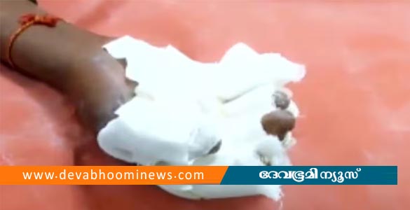തിളച്ച എണ്ണയില്‍ കൈമുക്കി പാതിവ്രത്യം തെളിയിക്കല്‍: യുവതിക്ക് ഗുരുതര പരിക്ക്