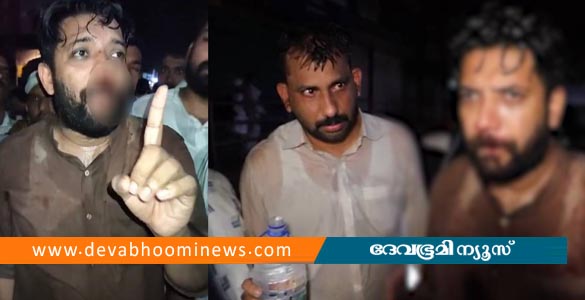 പേരാമ്പ്രയില്‍ യുഡിഎഫ്-എല്‍ഡിഎഫ് സംഘര്‍ഷം; ഷാഫി പറമ്പിൽ എംപിക്ക് പരിക്ക്