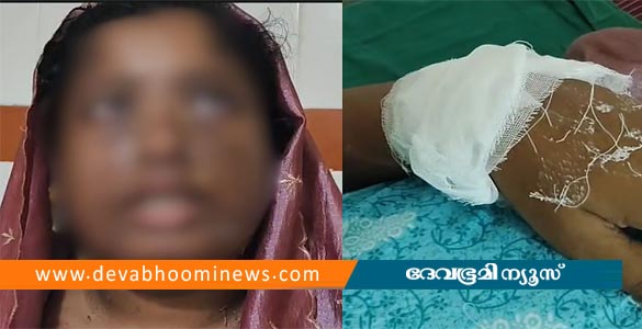 ആഭിചാരക്രിയയ്ക്ക് കൂട്ടു നിന്നില്ല; കൊല്ലത്ത് ഭാര്യയുടെ മുഖത്ത് തിളച്ച മീൻകറി ഒഴിച്ച് ഭർത്താവ്