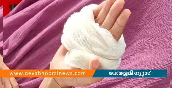 ട്യൂഷൻ ക്ലാസിലെ പരീക്ഷയിൽ രണ്ട് മാർക്ക് കുറഞ്ഞു; വിദ്യാർഥിക്ക് അധ്യാപകന്&zwj;റെ ക്രൂരമർദനം