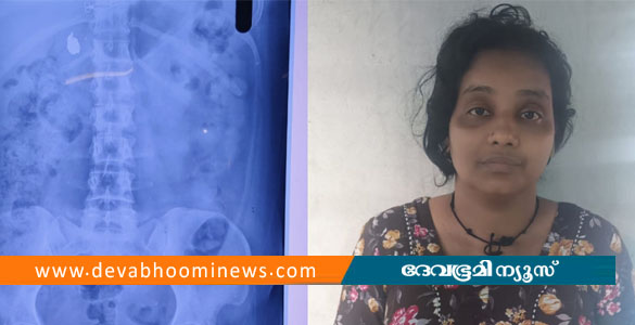 കുഞ്ഞിനെ ലാളിക്കുന്നതിനിടെ മോഷ്ടിച്ച സ്വര്&zwj;ണമാല വിഴുങ്ങി; മലപ്പുറത്ത് യുവതി പിടിയില്&zwj;