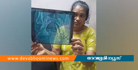 വയറ്റില്&zwj; കത്രിക കുടുങ്ങിയ സംഭവം; ഡോക്ടര്&zwj;ക്കും നഴ്&zwnj;സിനും സസ്&zwnj;പെന്&zwj;ഷന്&zwj;