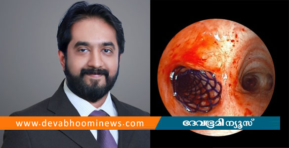 കേരളത്തിൽ ആദ്യമായി ബയോഡീഗ്രേഡബിൾ എയർവേ സ്റ്റെന്റിങ് അമൃത ആശുപത്രിയിൽ; ചരിത്രനേട്ടം