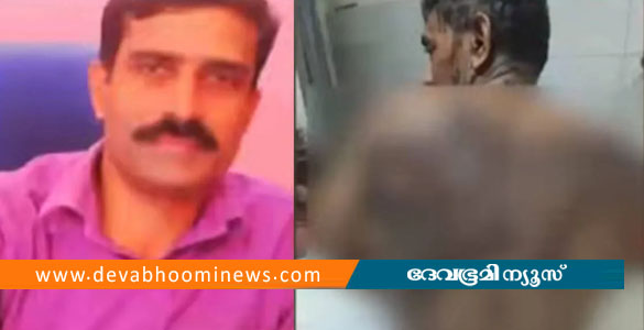 പാ​ല​ക്കാ​ട് യുവാവിനെ ആസിഡ് ഒഴിച്ച് കൊലപ്പെടുത്താൻ ശ്രമം; അ​യ​ൽ​വാ​സി അറസ്റ്റിൽ