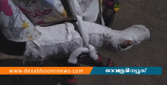 ഒന്നാം ക്ലാസുകാരിക്ക് അധ്യാപികയുടെ മർദ്ദനം; കൈവിരലിന് പൊട്ടൽ