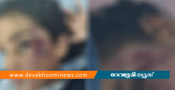വാട്സാപ്പ് ഡിലീറ്റ് ചെയ്തതിന് ആറു വയസുകാരിക്ക് ക്രൂരമർദനം: അമ്മ കസ്റ്റഡിയിൽ